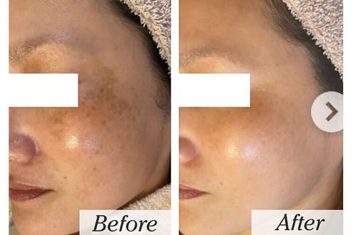 結果にこだわるシミケア専門サロンです。