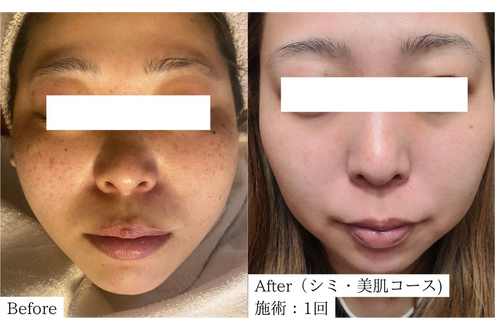 結果にこだわるシミケア専門サロンです。