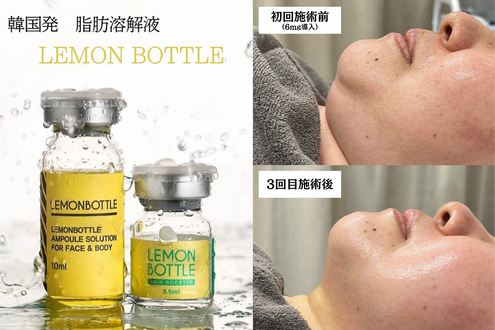 その他「韓国発レモンボトル」や「脱毛メニュー」もあり♪