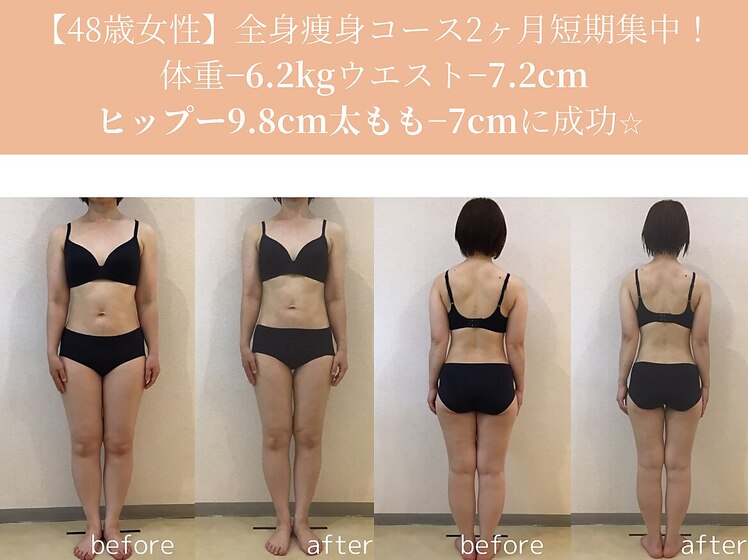 48歳ビフォーアフター